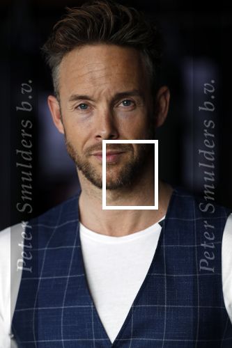 Amsterdam 15 maart 2018  
Presentatie kledinglijn Remy Bonjasky. Charly Luske met zijn arm in een brace na ongeluk met snowboard