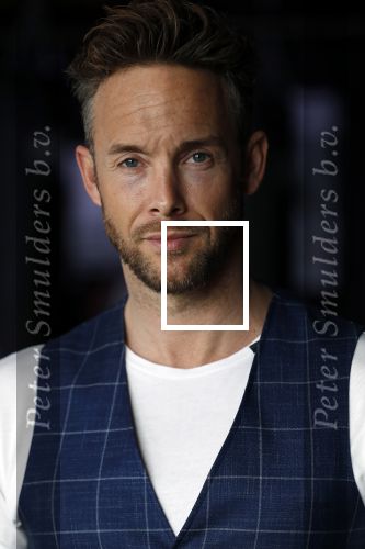 Amsterdam 15 maart 2018  
Presentatie kledinglijn Remy Bonjasky. Charly Luske met zijn arm in een brace na ongeluk met snowboard