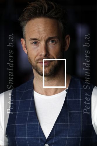 Amsterdam 15 maart 2018  
Presentatie kledinglijn Remy Bonjasky. Charly Luske met zijn arm in een brace na ongeluk met snowboard
