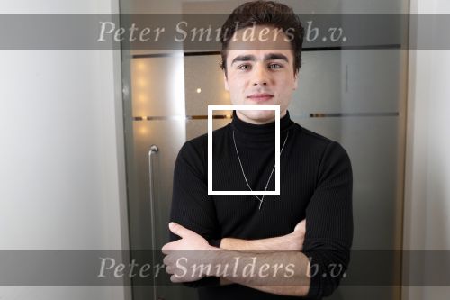 Amsterdam 25 maart 2019
Jordy v Loon bij de perspresentatie van de musical Haal het doek maar op in het DeLaMar Theater in Amsterdam