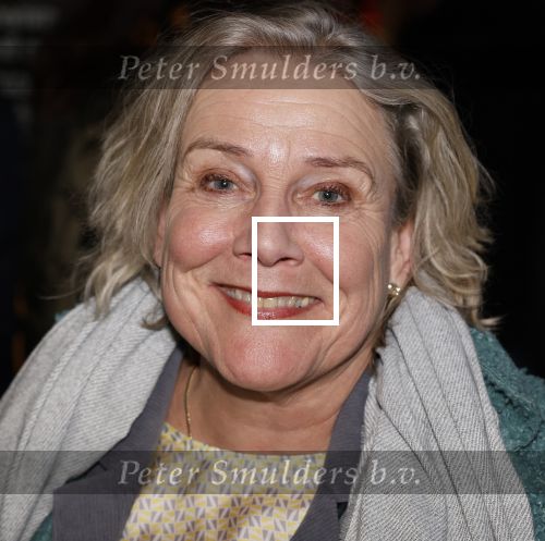 Amsterdam 10 maart 2024
Event alzheimer in het ziggo dome. Ank Beijleveld