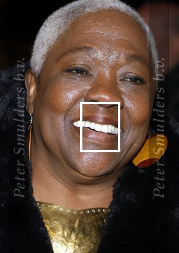 Amsterdam 10 maart 2024
Event alzheimer in het ziggo dome. Jetty Mathurin met ...