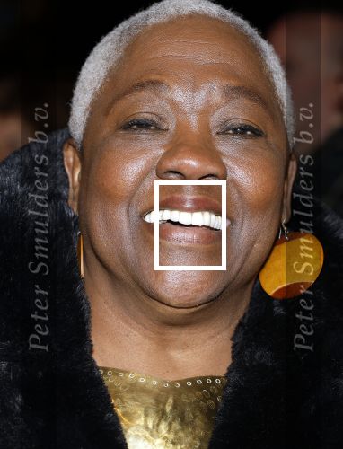 Amsterdam 10 maart 2024
Event alzheimer in het ziggo dome. Jetty Mathurin met ...
