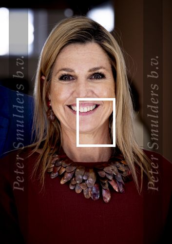 Zoetermeer 31 maart 2026
Koningin Maxima bij  de startbijeenkomst van Stichting GelijkGezond.