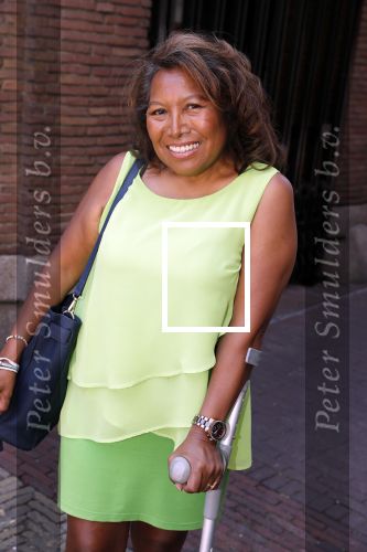 Amsterdam 15 juli 2018
Frits Huffnagel feestje voor zijn 50e verjaardag bij hotel the Grand. Justine Pelmelay op krukken