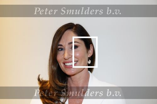 Amsterdam 10 juli 2025
Presentatie Bioteq Vitality van Connie Witteman bij haar thuis . Femke Weijenburg