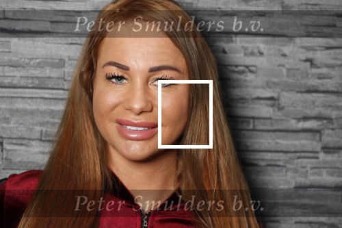 Den Haag 2 decenber 2018
Samantha de Jong ( Barbie) met haar nieuwe look.