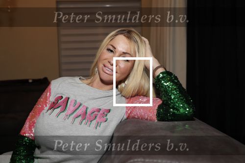 Scheveningen 30 november 2018
Exclusief intervieuw met Barbie (samantha de Jong) nadat ze terug gekomen is uit de afkickkliniek in Schotland. Karin Riethoven intervieuwt haar voor Story.