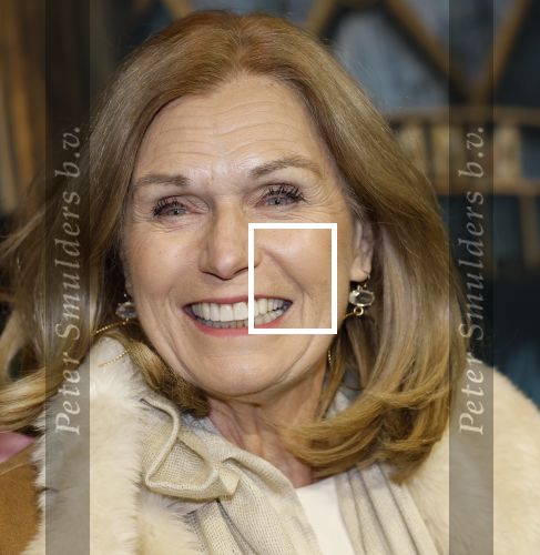 Amsterdam 18 november 2025
Premiere Wicked in het deLaMar theater . Liz Snoijink