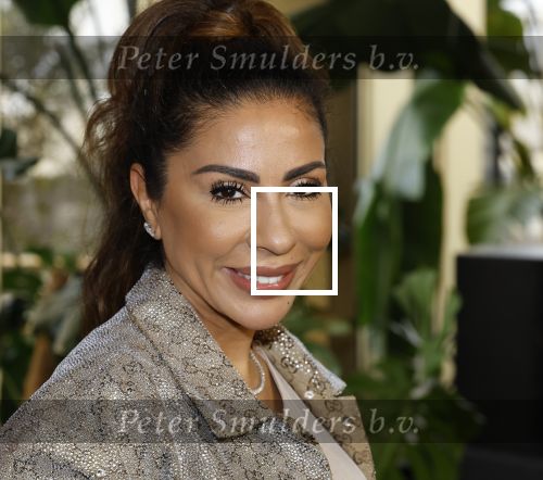 Amsterdam 11 november 2025
Presentatie real housewives of Amsterdam in het W hotel.
Aanwezig Niama Amhali Renee Vervoorn Cherry Ann Person Lilian Dziedzic Kimmylien Nguyen Djamila Celina en Elvira Penthesilea.