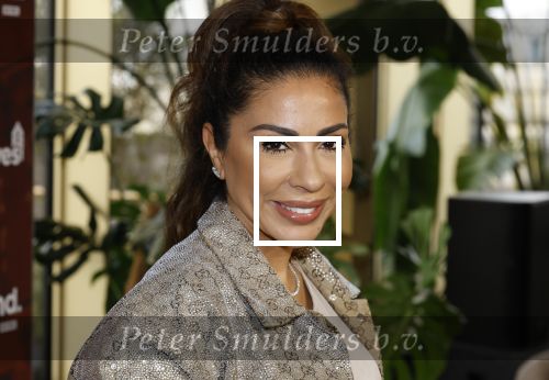 Amsterdam 11 november 2025
Presentatie real housewives of Amsterdam in het W hotel.
Aanwezig Niama Amhali Renee Vervoorn Cherry Ann Person Lilian Dziedzic Kimmylien Nguyen Djamila Celina en Elvira Penthesilea.