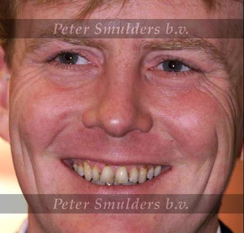 Den Haag, 24 januari 2001
Prins Willem Alexander
t.g.v. uitreiking boek Olympische spelen
Gebit
