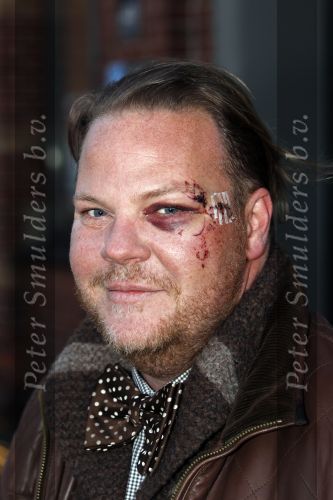 Amsterdam 28 januari 2011
Modeshow Addy v d Krommenacker op de amsterdam fashion week. Bastiaan v Schaijk na ongeluk met blauw oog
Peter Smulders bv