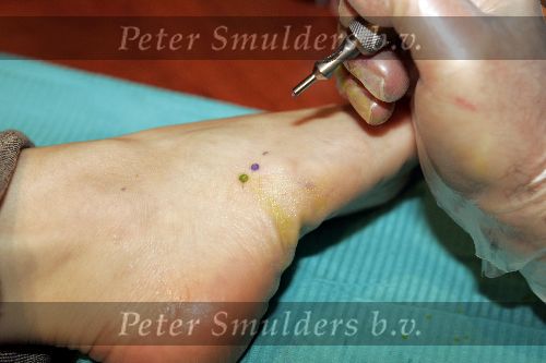 Hilversum 9 februari 2005
Aukje v Ginneken laat radio 538 logo op voet tattooeren door tattoo Bob. 
Peter Smulders bv