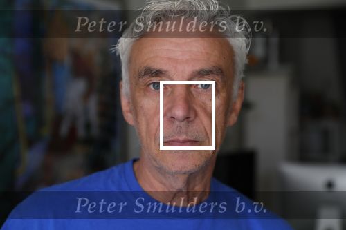 Sluis 6 juni 2019
Robert Weijers de ex partner van Rob Verlinden in zijn huisje in Sluis en met zijn hond en camper.