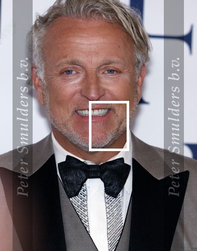 Amsterdam 8 juni 2024
Het Amsterdam diner in AFAS live . Vele Bekende mensen en zakenmensen kwamen naar het gala waar geld opgehaald wordt voor het aids fonds. Gordon kwam met een goede vriendin