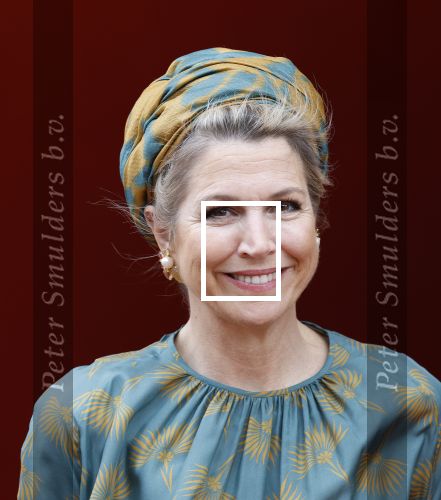 Capelle aan de Ijssel 3 juni 2025
Koningin Maxima opent het nieuwe kantoor van Bergman Clinics.