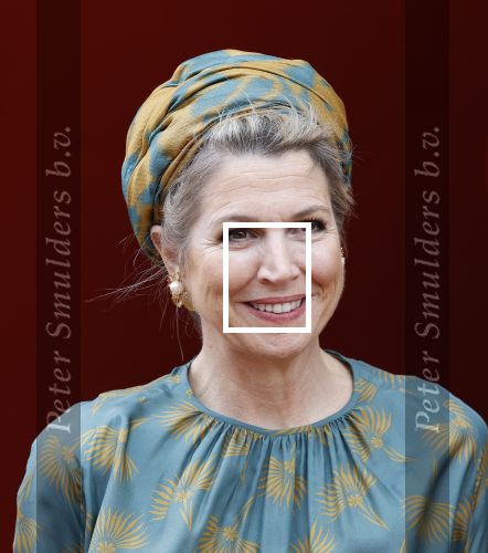 Capelle aan de Ijssel 3 juni 2025
Koningin Maxima opent het nieuwe kantoor van Bergman Clinics.