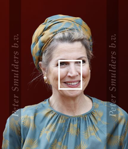 Capelle aan de Ijssel 3 juni 2025
Koningin Maxima opent het nieuwe kantoor van Bergman Clinics.