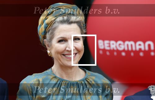 Capelle aan de Ijssel 3 juni 2025
Koningin Maxima opent het nieuwe kantoor van Bergman Clinics.