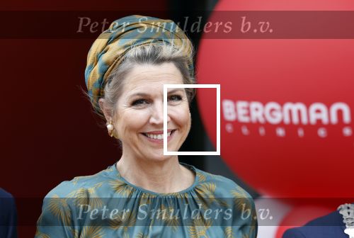 Capelle aan de Ijssel 3 juni 2025
Koningin Maxima opent het nieuwe kantoor van Bergman Clinics.