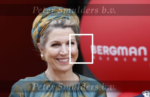 Capelle aan de Ijssel 3 juni 2025
Koningin Maxima opent het nieuwe kantoor van Bergman Clinics.