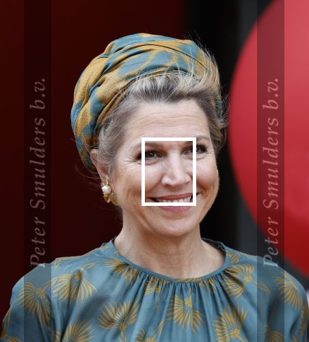 Capelle aan de Ijssel 3 juni 2025
Koningin Maxima opent het nieuwe kantoor van Bergman Clinics.