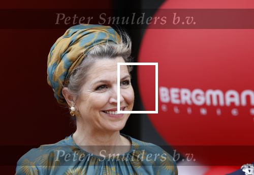 Capelle aan de Ijssel 3 juni 2025
Koningin Maxima opent het nieuwe kantoor van Bergman Clinics.