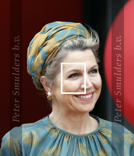 Capelle aan de Ijssel 3 juni 2025
Koningin Maxima opent het nieuwe kantoor van Bergman Clinics.