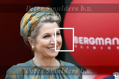 Capelle aan de Ijssel 3 juni 2025
Koningin Maxima opent het nieuwe kantoor van Bergman Clinics.
