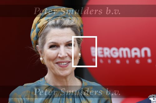 Capelle aan de Ijssel 3 juni 2025
Koningin Maxima opent het nieuwe kantoor van Bergman Clinics.