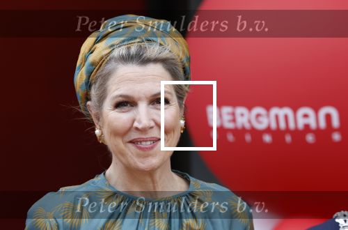 Capelle aan de Ijssel 3 juni 2025
Koningin Maxima opent het nieuwe kantoor van Bergman Clinics.