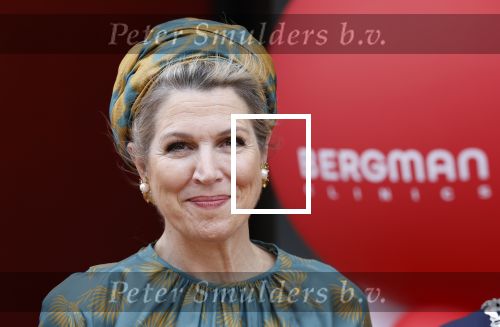 Capelle aan de Ijssel 3 juni 2025
Koningin Maxima opent het nieuwe kantoor van Bergman Clinics.