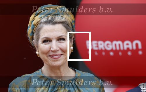 Capelle aan de Ijssel 3 juni 2025
Koningin Maxima opent het nieuwe kantoor van Bergman Clinics.