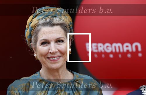 Capelle aan de Ijssel 3 juni 2025
Koningin Maxima opent het nieuwe kantoor van Bergman Clinics.