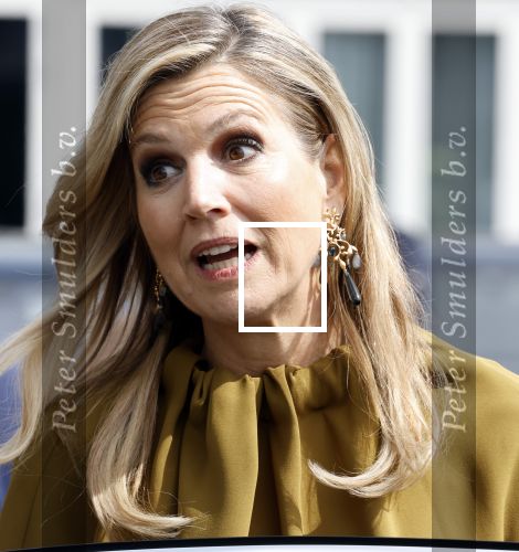 Amsterdam 11 juni 2025
Koningin Maxima vertrekt bij de RAI om naar haar dochter Prinses Amalia te gaan die in het ziekenhuis ligt ivm val van haar paard.