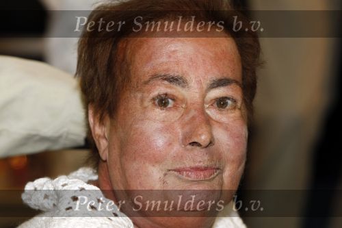Amsterdam 25 juni 2009
Opening galerie van Josine v Dalsum. Josine kwam in rolstoel en was erg emotioneel. Haar man John v d Rest deed het woord.
Peter Smulders bv