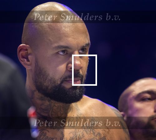 Rotterdam 03-03-2018 
Badr Harie vs Hesdy Gerges - GLORY 51 SuperFight