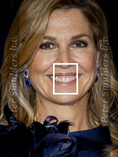 Den Haag 25 Februari 2026
Koningin Maxima der Nederlanden woont de jaarlijkse Iftar-bijeenkomst van MKB (SME) Den Haag bij in het Grand Hotel Kurhaus in Scheveningen