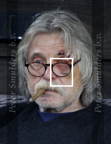 Grolloo 6 april 2019
Johan Derksen in de tuin van zijn huis na zijn ongeluk.