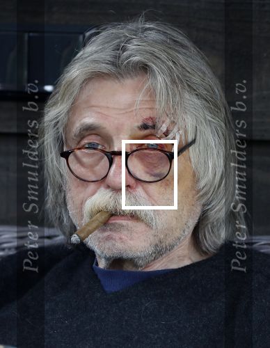 Grolloo 6 april 2019
Johan Derksen in de tuin van zijn huis na zijn ongeluk.