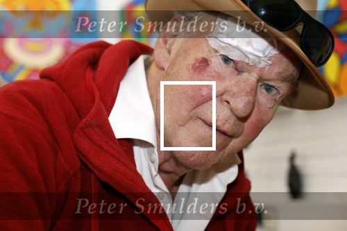Amsterdam 1 mei 2022
Peter Faber na ongeluk in zijn atelier aan het werk.