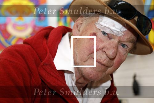 Amsterdam 1 mei 2022
Peter Faber na ongeluk in zijn atelier aan het werk.