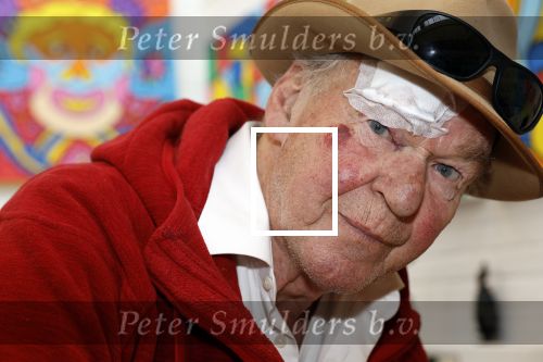 Amsterdam 1 mei 2022
Peter Faber na ongeluk in zijn atelier aan het werk.