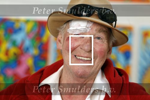 Amsterdam 1 mei 2022
Peter Faber na ongeluk in zijn atelier aan het werk.