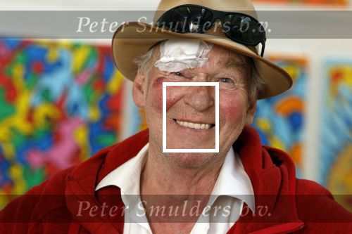 Amsterdam 1 mei 2022
Peter Faber na ongeluk in zijn atelier aan het werk.