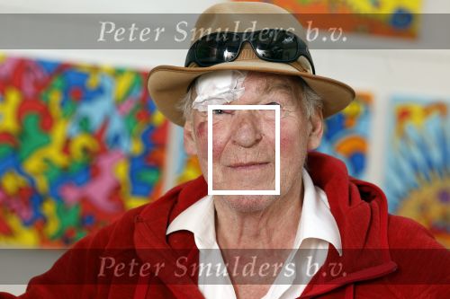 Amsterdam 1 mei 2022
Peter Faber na ongeluk in zijn atelier aan het werk.