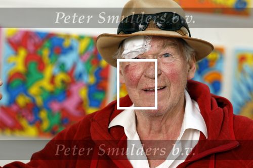 Amsterdam 1 mei 2022
Peter Faber na ongeluk in zijn atelier aan het werk.