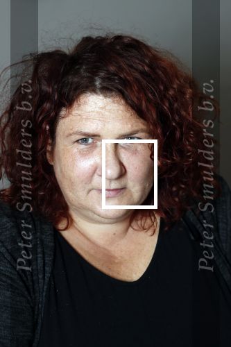 Amsterdam 4 oktober 2018
Bruni Heinke wordt behandels door Agniezka van Bodyfix.