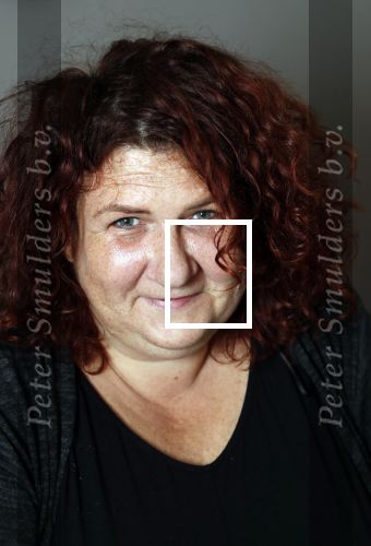 Amsterdam 4 oktober 2018
Bruni Heinke wordt behandels door Agniezka van Bodyfix.
